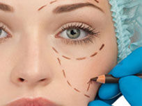 blepharoplastie